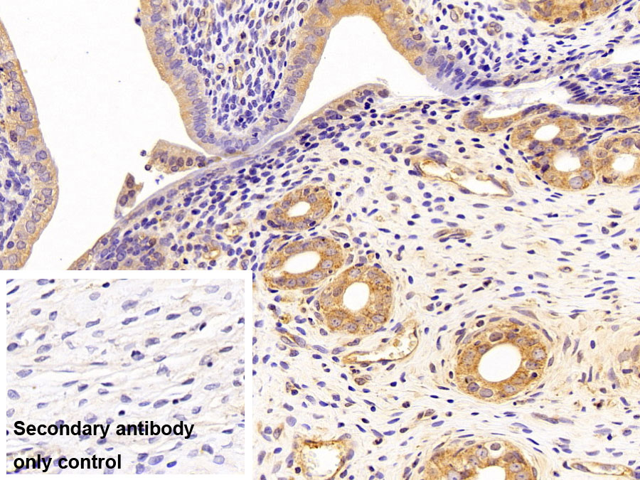 Monoclonal Antibody to Aspartate Aminotransferase 2 (AST2)