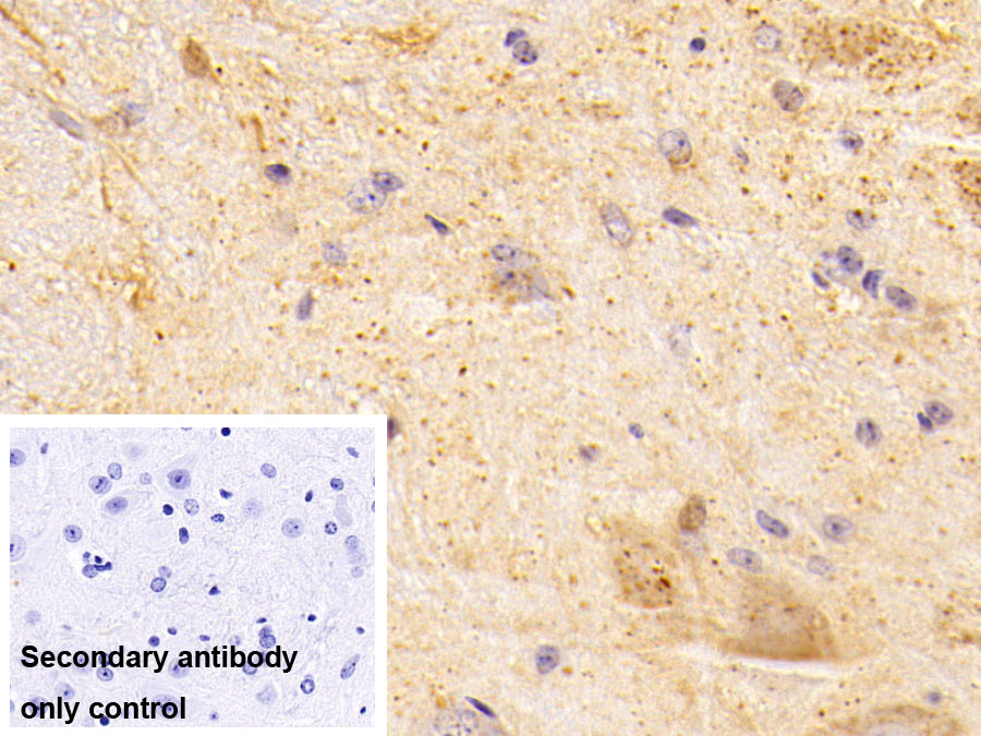 Monoclonal Antibody to Aspartate Aminotransferase 2 (AST2)