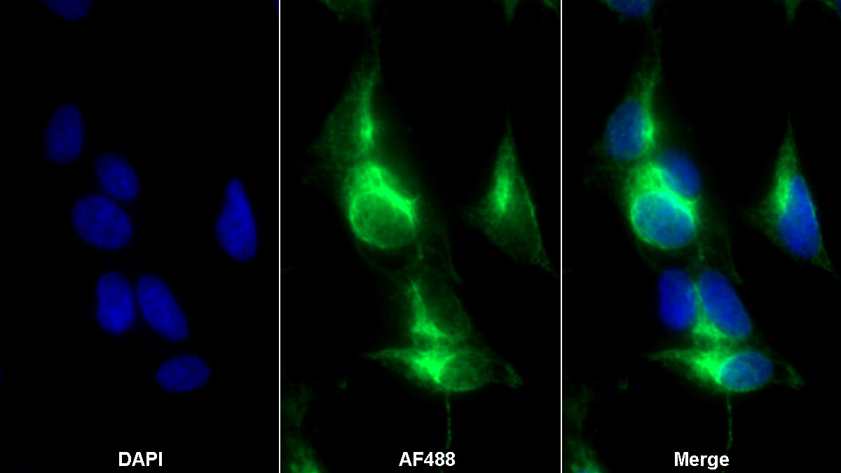 Monoclonal Antibody to Neurofilament, Light Polypeptide (NEFL)