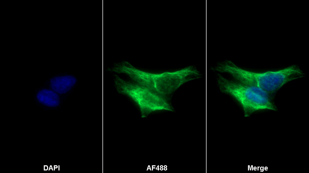 Monoclonal Antibody to Neurofilament, Light Polypeptide (NEFL)