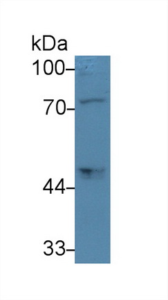 Monoclonal Antibody to Proprotein Convertase Subtilisin/Kexin Type 9 (PCSK9)