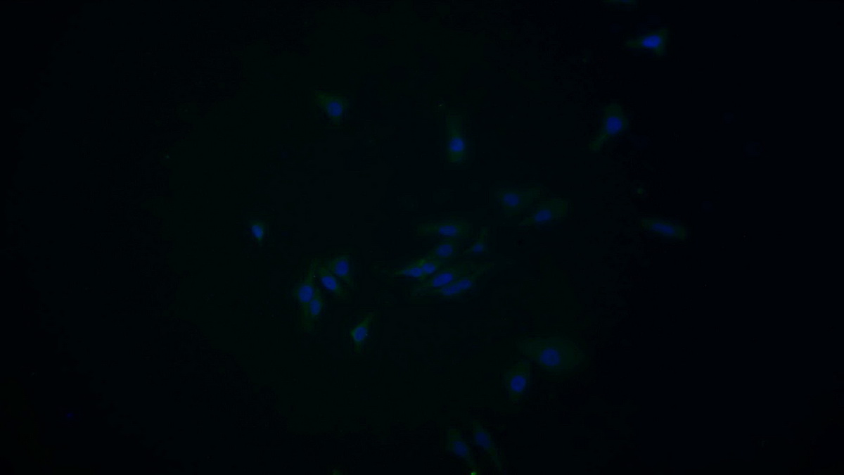 Monoclonal Antibody to 4-Hydroxyphenylpyruvate Dioxygenase (HPD)