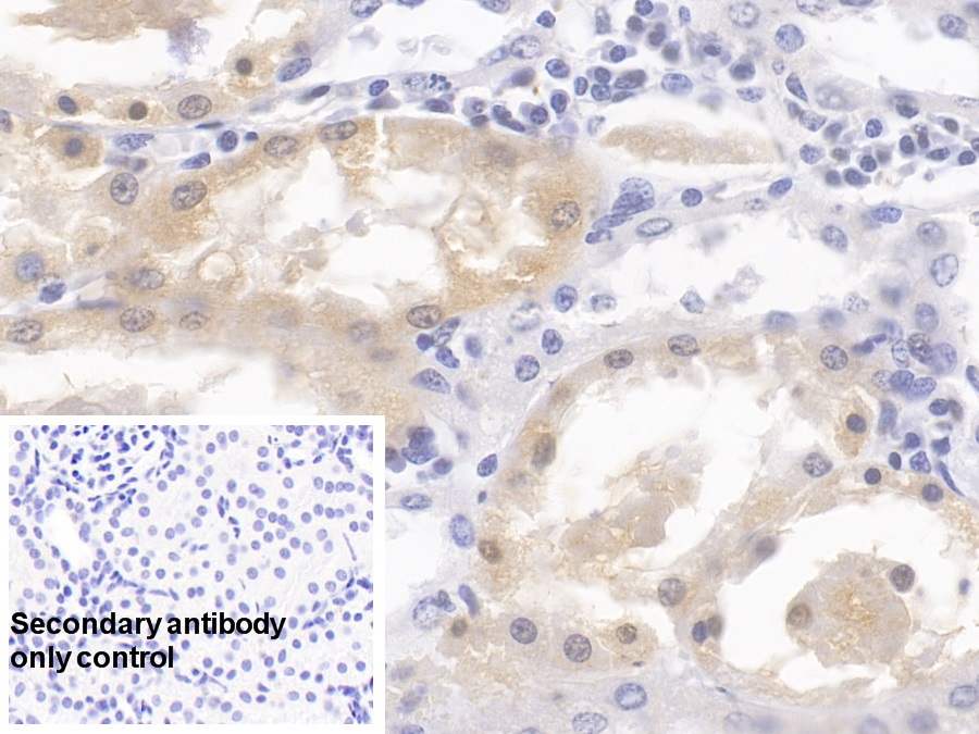 Monoclonal Antibody to 4-Hydroxyphenylpyruvate Dioxygenase (HPD)