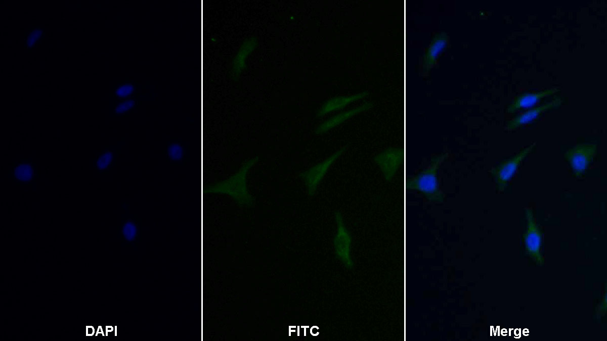 Monoclonal Antibody to 4-Hydroxyphenylpyruvate Dioxygenase (HPD)