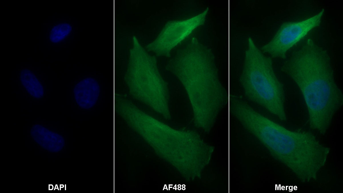 Monoclonal Antibody to 4-Hydroxyphenylpyruvate Dioxygenase (HPD)