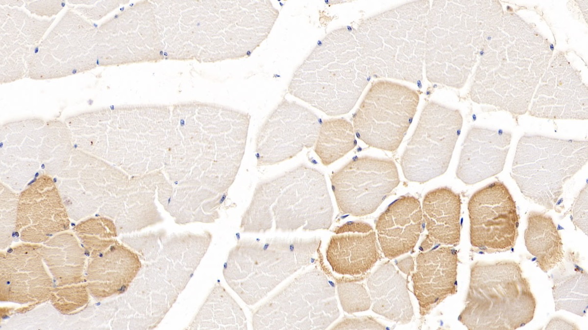 Monoclonal Antibody to Tryptophan-2,3-dioxygenase (TDO)