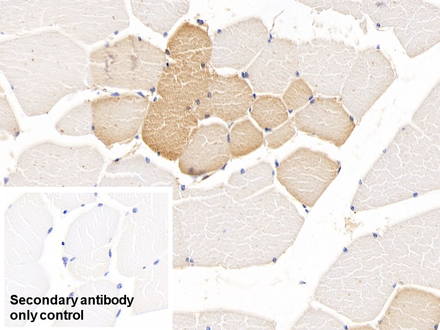 Monoclonal Antibody to Tryptophan-2,3-dioxygenase (TDO)