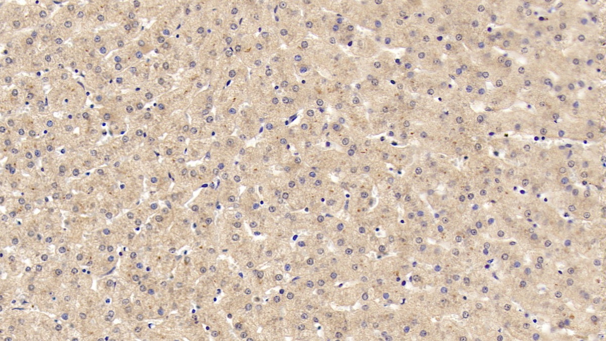 Monoclonal Antibody to C-Ros Oncogene 1, Receptor Tyrosine Kinase (ROS1)