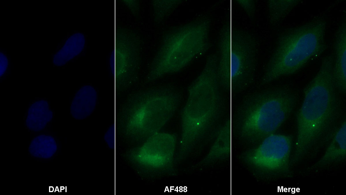 Monoclonal Antibody to Organic Cation/Ergothioneine Transporter (OCTN1)