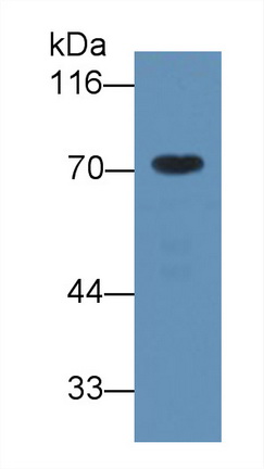 Monoclonal Antibody to Alpha-1-B-Glycoprotein (a1BG)