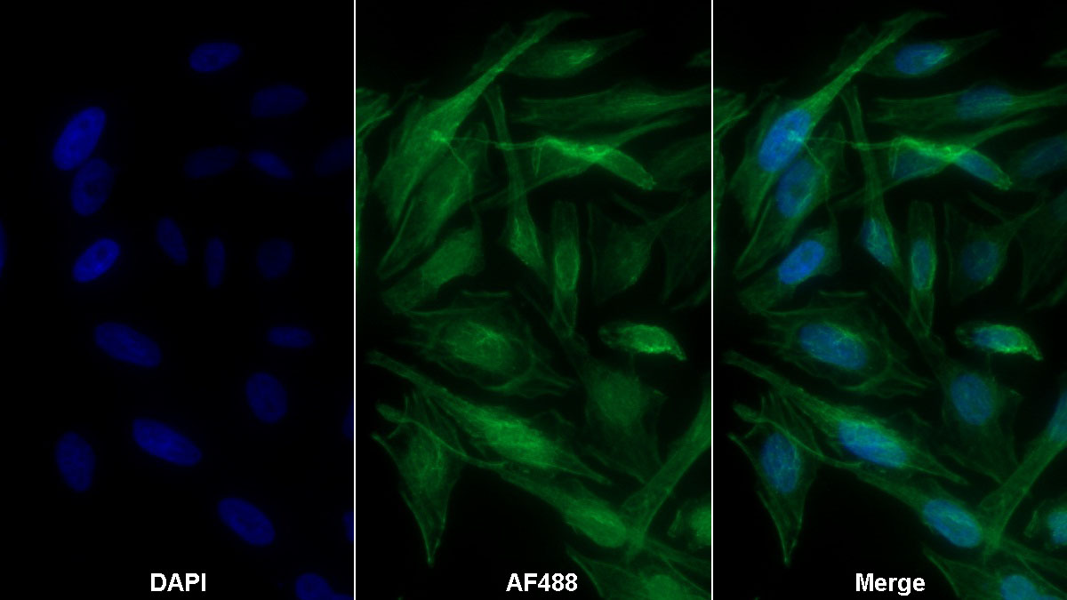 Monoclonal Antibody to Alpha-1-B-Glycoprotein (a1BG)