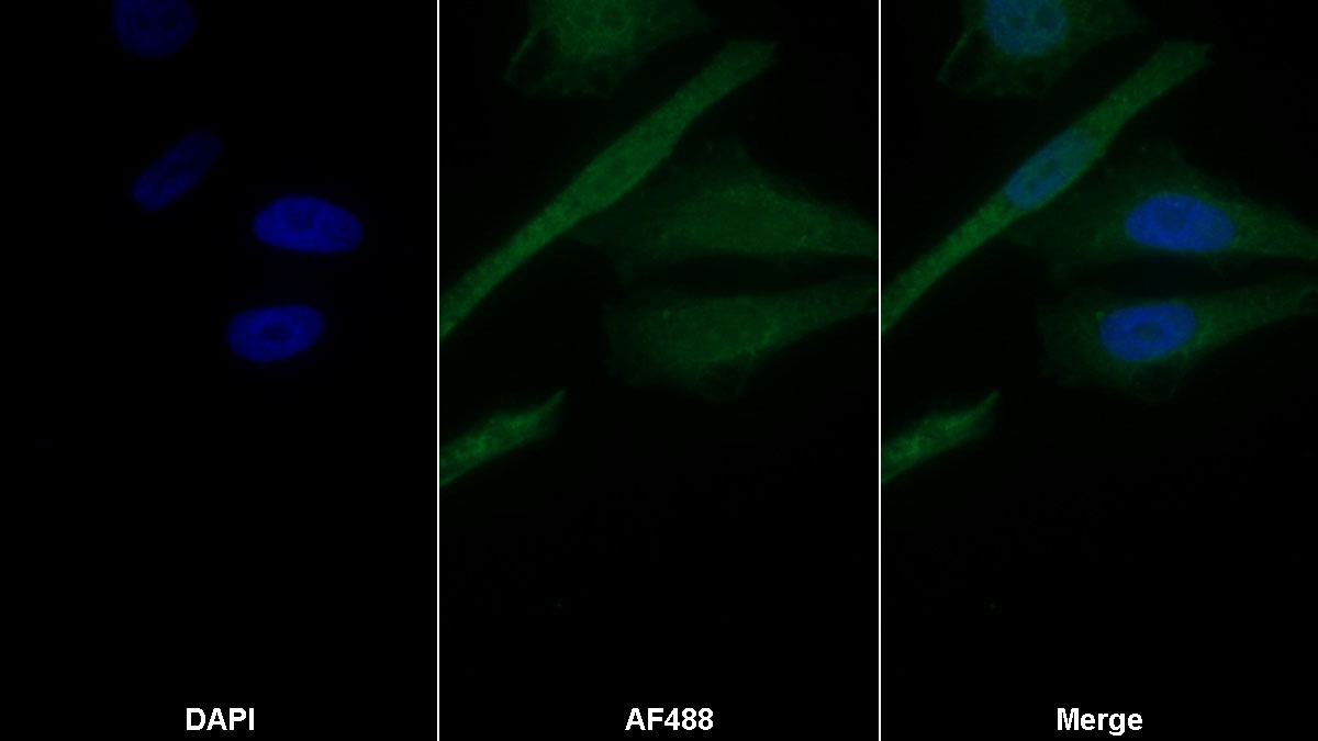 Monoclonal Antibody to Alpha-1-B-Glycoprotein (a1BG)