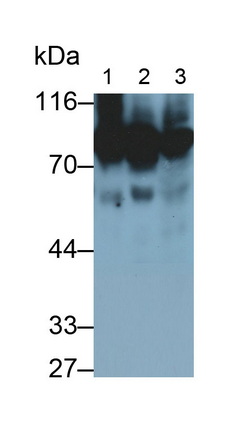 Monoclonal Antibody to Alpha-1-B-Glycoprotein (a1BG)