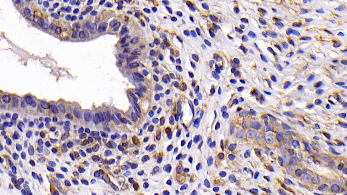 Monoclonal Antibody to B-Cell CLL/Lymphoma 2 Like Protein (Bcl2L)