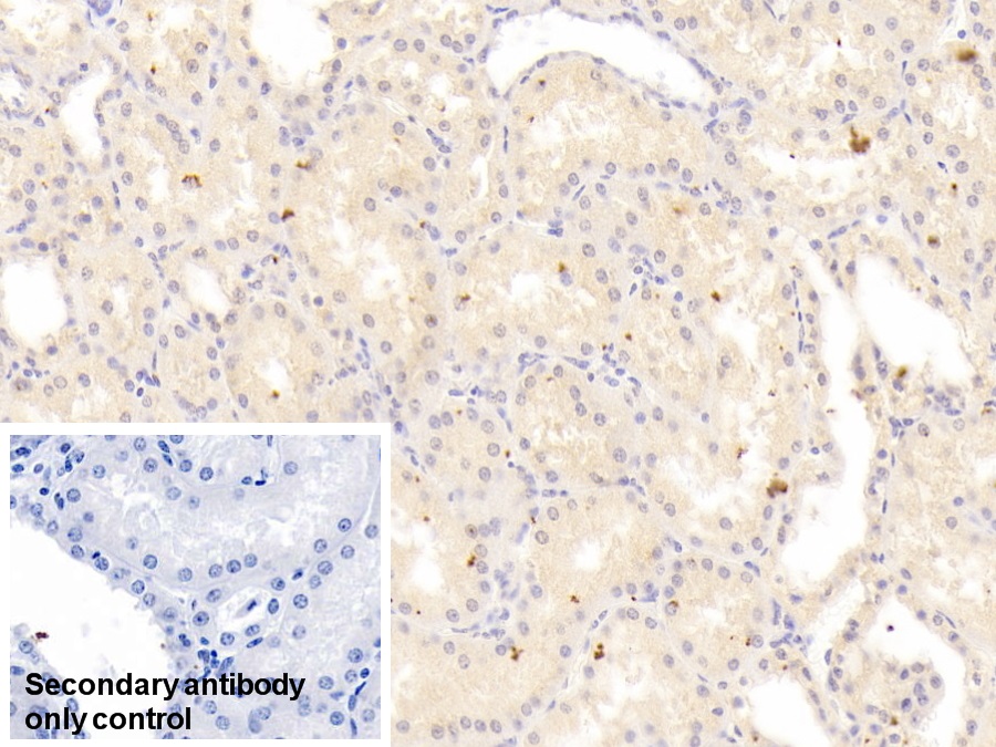 Monoclonal Antibody to Receptor Interacting Serine Threonine Kinase 1 (RIPK1)