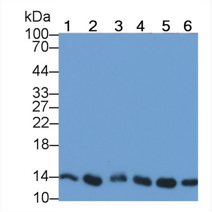 Monoclonal Antibody to FK506 Binding Protein 1A (FKBP1A)