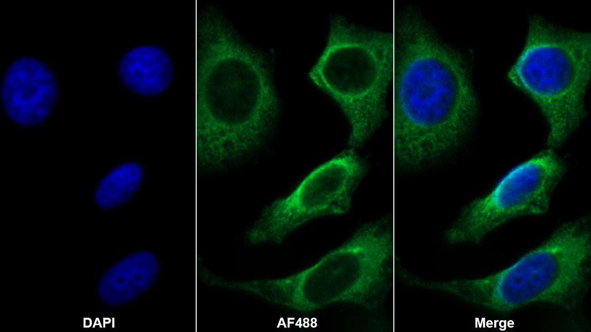 Monoclonal Antibody to FK506 Binding Protein 1A (FKBP1A)