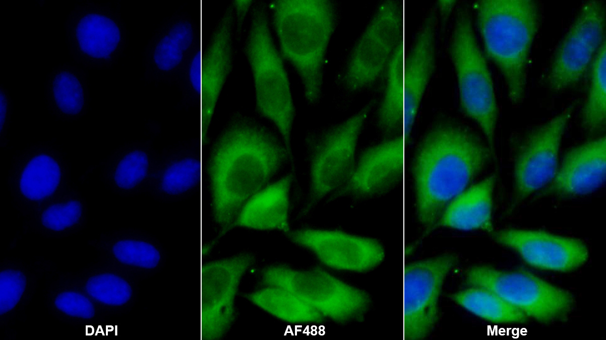 Monoclonal Antibody to Karyopherin Alpha 2 (KPNa2)