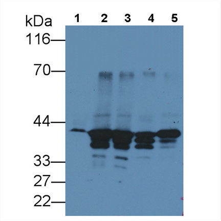 Monoclonal Antibody to Annexin A1 (ANXA1)