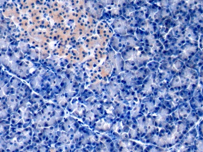 Monoclonal Antibody to Annexin A1 (ANXA1)