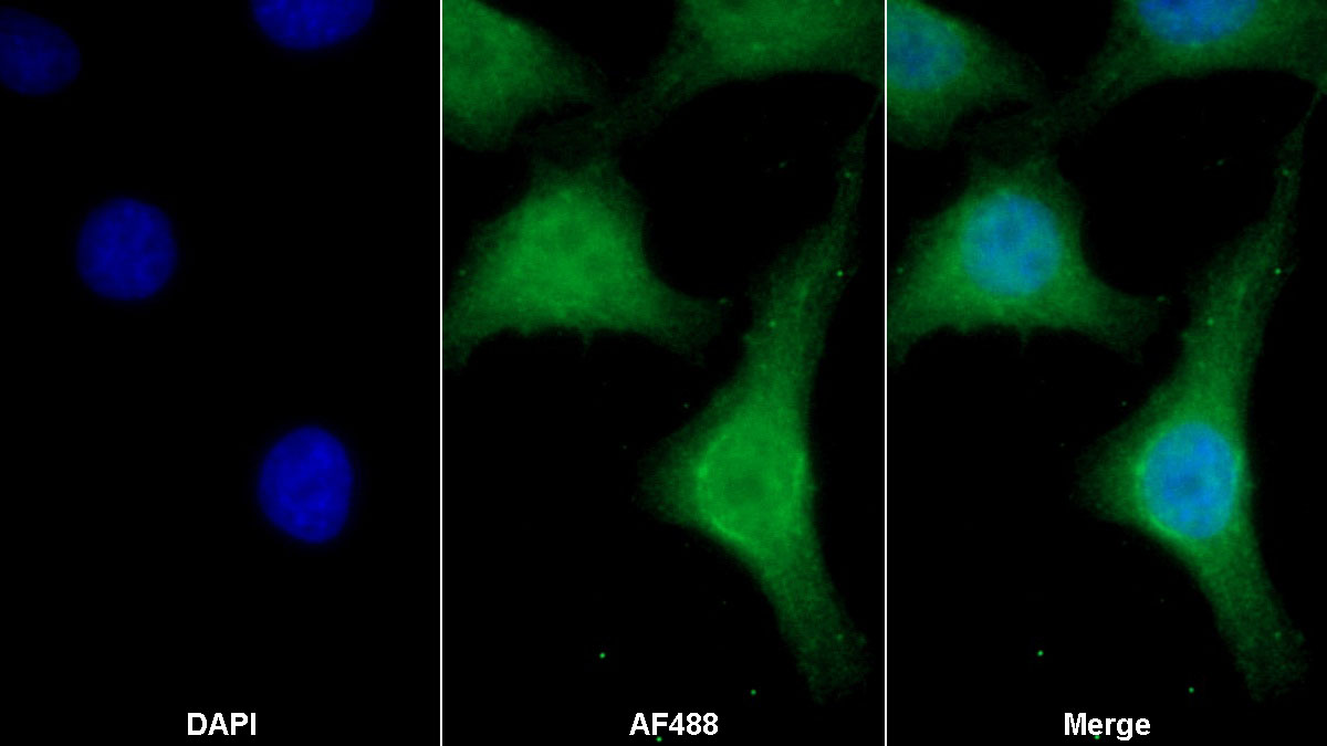 Monoclonal Antibody to Sirtuin 1 (SIRT1)