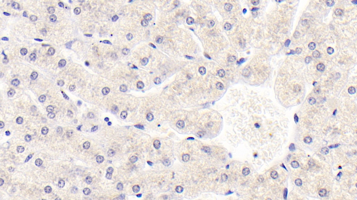 Monoclonal Antibody to Sirtuin 3 (SIRT3)