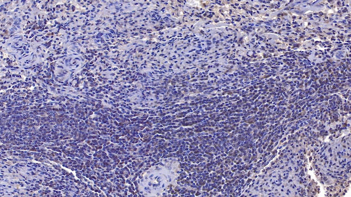 Monoclonal Antibody to Sirtuin 3 (SIRT3)