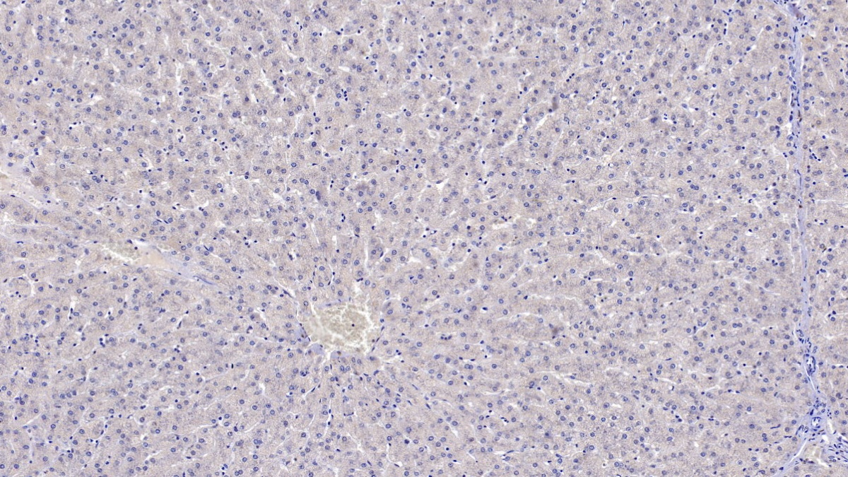 Monoclonal Antibody to Sirtuin 3 (SIRT3)