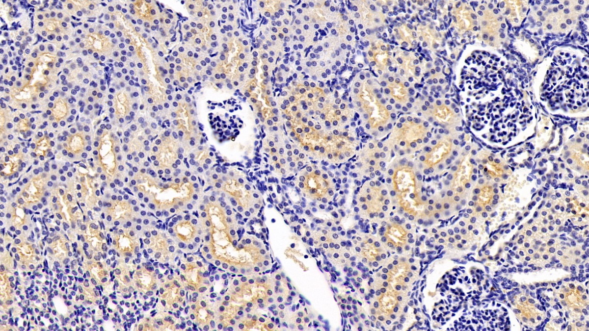 Monoclonal Antibody to Anthrax Toxin Receptor 2 (ANTXR2)