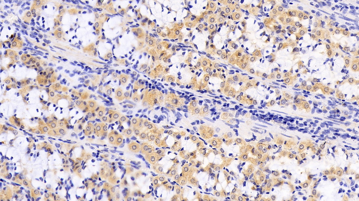 Monoclonal Antibody to Anthrax Toxin Receptor 2 (ANTXR2)