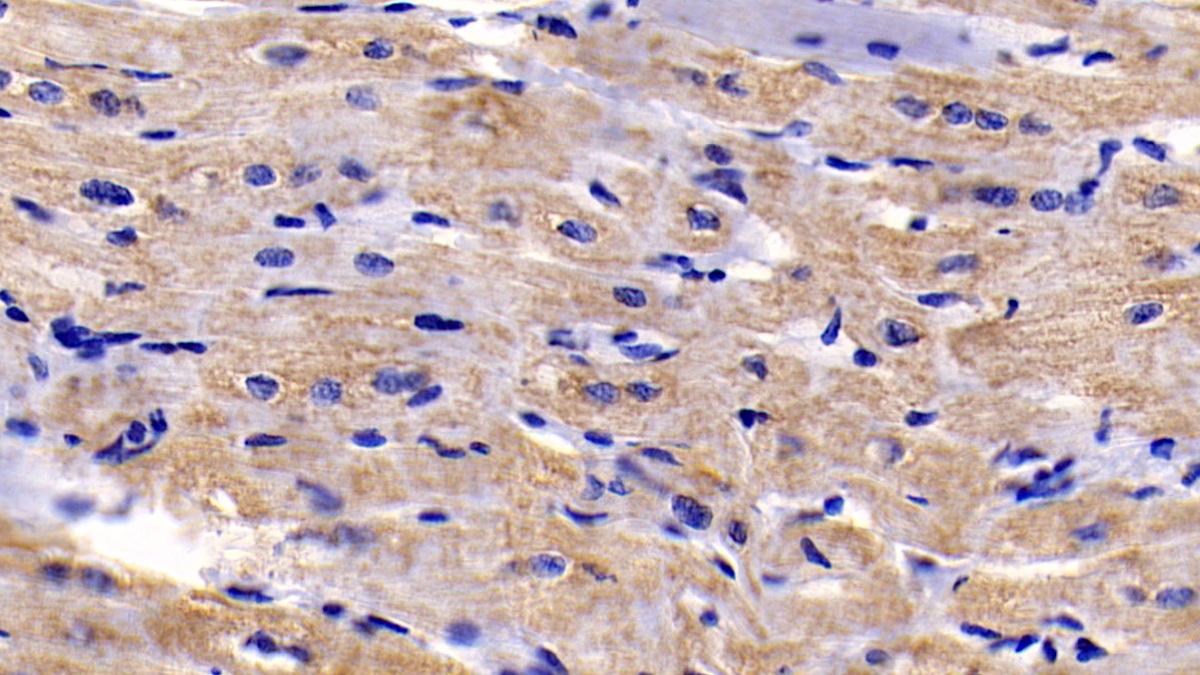 Monoclonal Antibody to Brain Specific Angiogenesis Inhibitor 3 (BAI3)