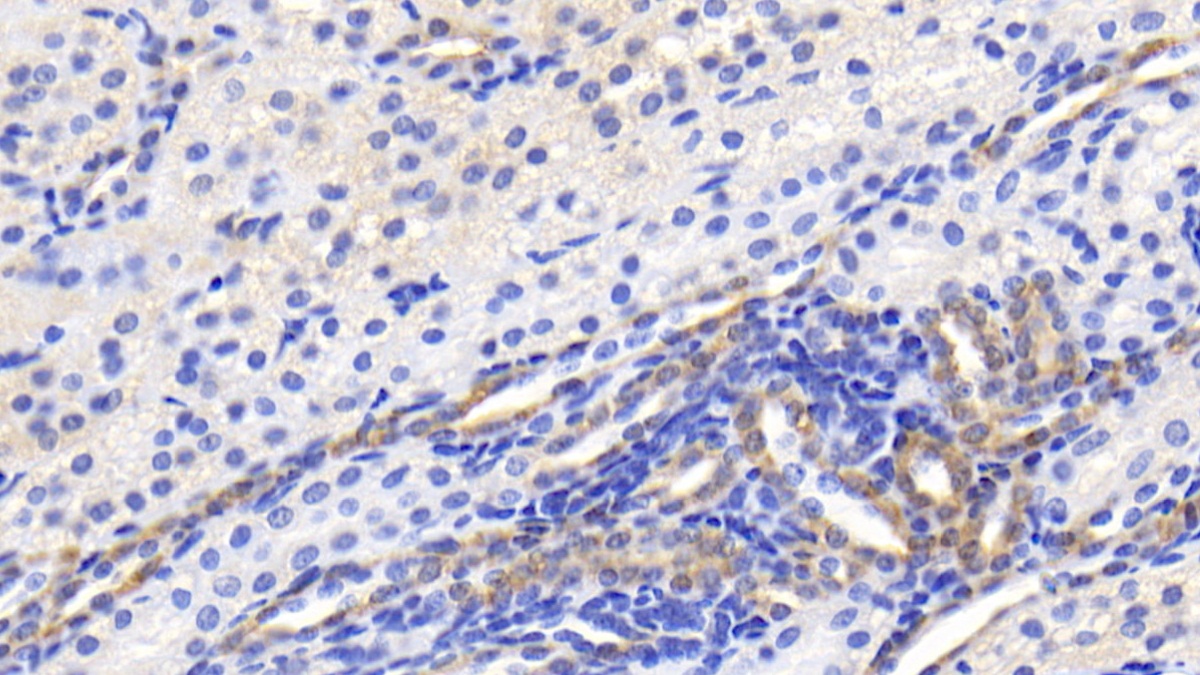 Monoclonal Antibody to Brain Specific Angiogenesis Inhibitor 3 (BAI3)