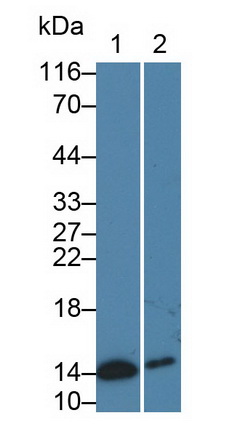 Monoclonal Antibody to Cellular Retinoic Acid Binding Protein 2 (CRABP2)