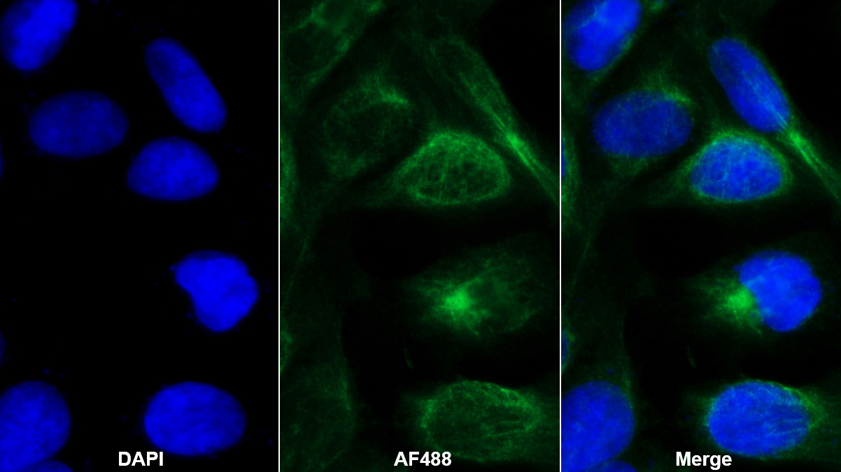 Monoclonal Antibody to Crystallin Lambda 1 (CRYl1)