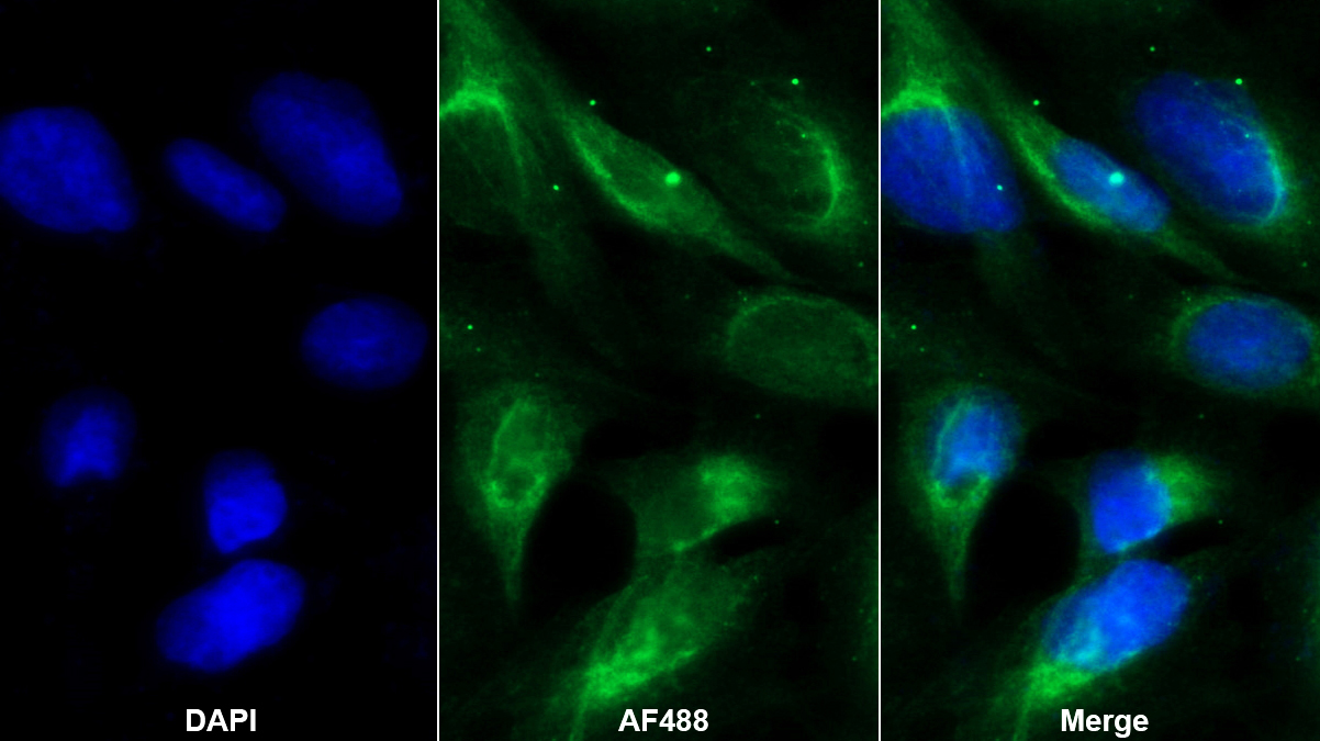 Monoclonal Antibody to Crystallin Lambda 1 (CRYl1)