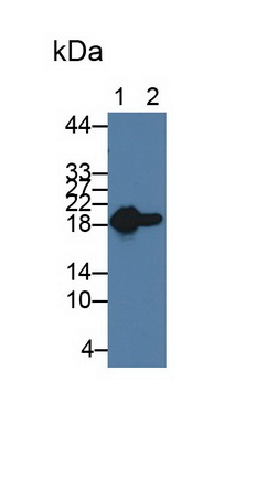 Monoclonal Antibody to Heat Shock Protein Beta 6 (HSPb6)