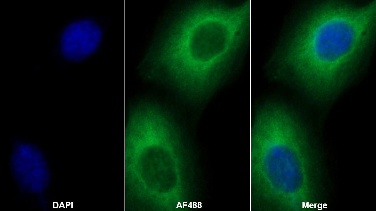 Monoclonal Antibody to Heat Shock Protein Beta 6 (HSPb6)