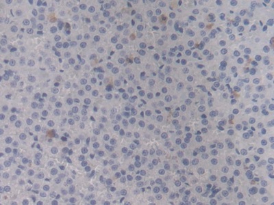 Monoclonal Antibody to Heat Shock Protein Beta 6 (HSPb6)