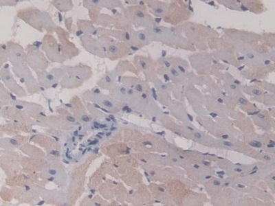 Monoclonal Antibody to Heat Shock Protein Beta 6 (HSPb6)