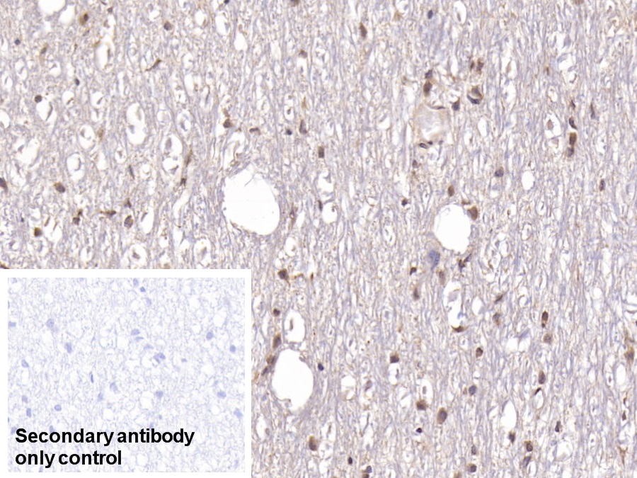 Monoclonal Antibody to Doublecortin Like Kinase 1 (DCLK1)