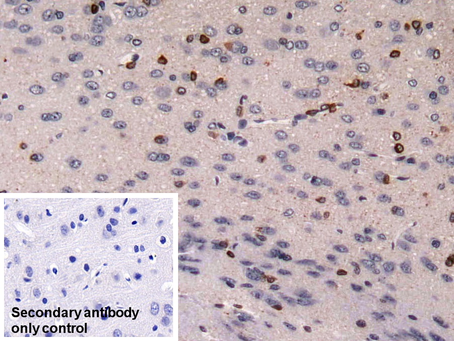 Monoclonal Antibody to Doublecortin Like Kinase 1 (DCLK1)