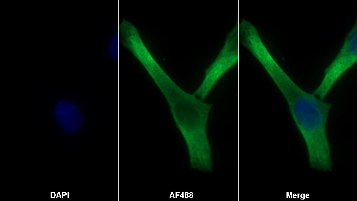 Monoclonal Antibody to Hyaluronan Synthase 2 (HAS2)