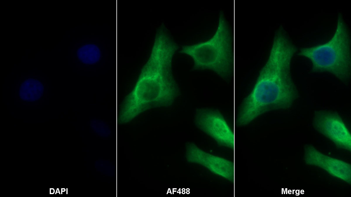 Monoclonal Antibody to Hyaluronan Synthase 2 (HAS2)