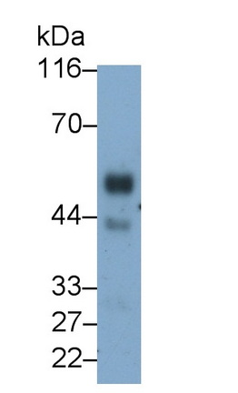 Monoclonal Antibody to Kisspeptin Receptor (KISS1R)