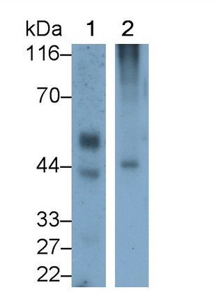 Monoclonal Antibody to Kisspeptin Receptor (KISS1R)