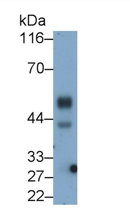 Monoclonal Antibody to Kisspeptin Receptor (KISS1R)