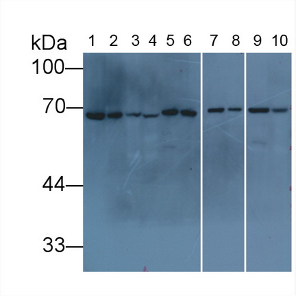 Monoclonal Antibody to Lamin B1 (LMNB1)