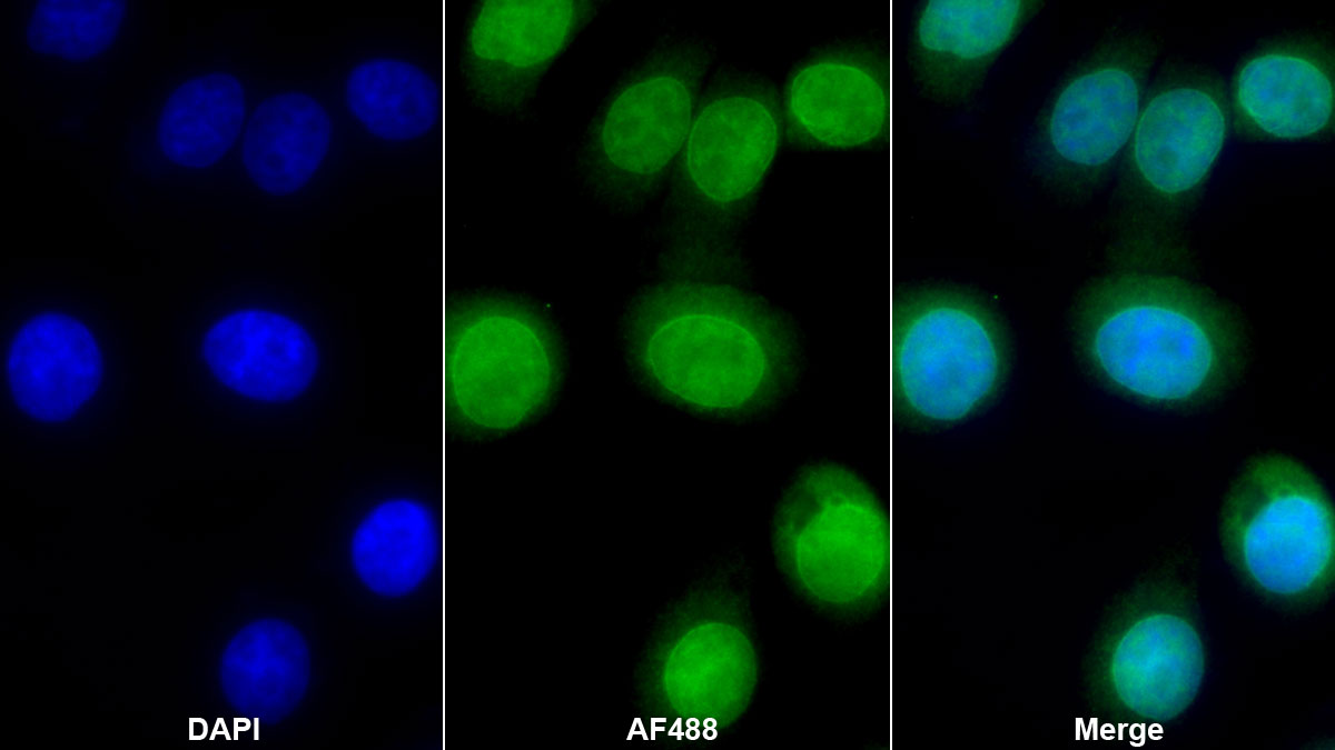 Monoclonal Antibody to Lamin B1 (LMNB1)