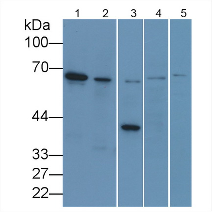 Monoclonal Antibody to Lamin B1 (LMNB1)