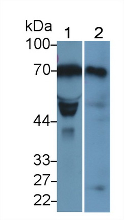 Monoclonal Antibody to Lysyl Oxidase Like Protein 1 (LOXL1)